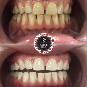 Анна , Суми Фото - 26