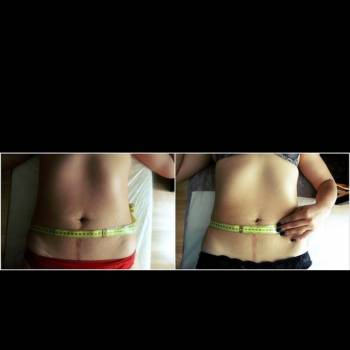 Body Massage, Житомир Фото - 6