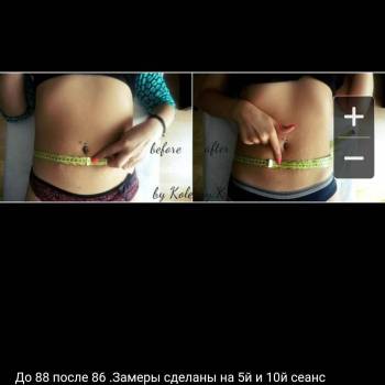 Body Massage, Житомир Фото - 8