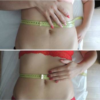 Body Massage, Житомир Фото - 9