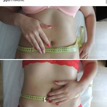 Body Massage, Житомир Фото - 11