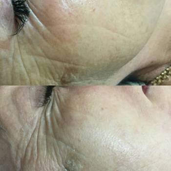 Фото с портфолио Ольга Ковальчук 