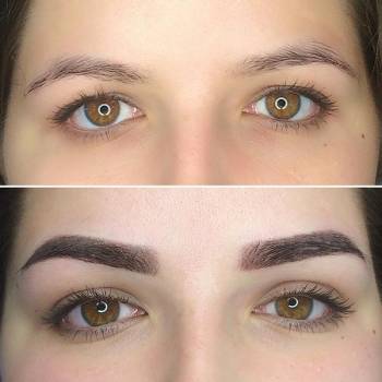 Татьяна Козерук , Житомир Фото - 13