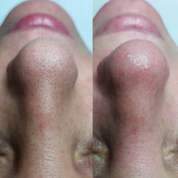 Виктория Величко , Черкассы Фото - 5