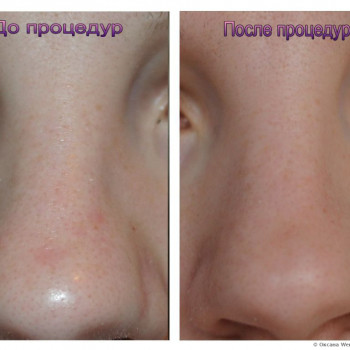 Фото с портфолио Ирина Васильевна Грабовская