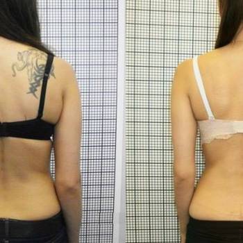 Eurospine, Маріуполь Фото - 5