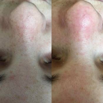 Фото с портфолио Юлия 