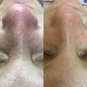 Фото с портфолио Юлия 