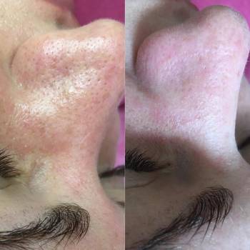 Фото с портфолио Юлия 