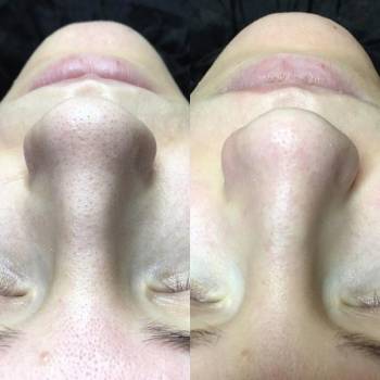 Фото с портфолио Юлия 