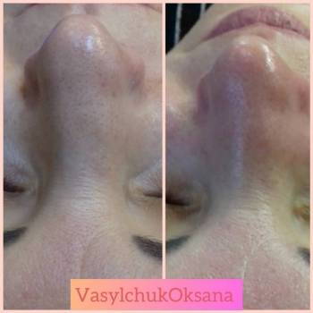 Оксана Васильчук , Черкассы Фото - 16