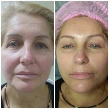 Солодка Перлинка, Черкаси Фото - 6