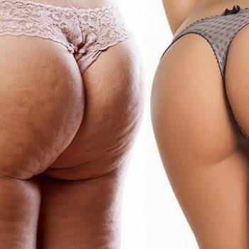 Фото с портфолио New Ton beauty