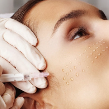 Мезотерапия
                    Косметологический центр Надия Кривой Рог