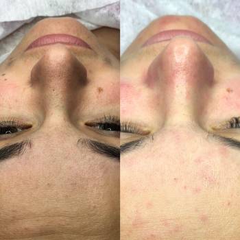 Кристина Назим , Днепр Фото - 8