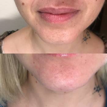 Елена Викторовна Безверхая , Кривой Рог Фото - 6