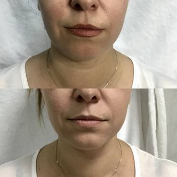 Елена Викторовна Безверхая , Кривой Рог Фото - 7