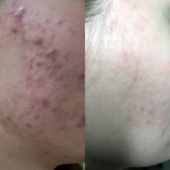 Елена Викторовна Безверхая , Кривой Рог Фото - 8