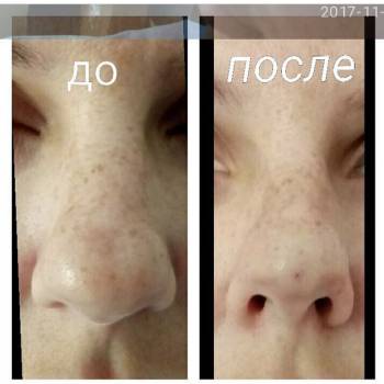 Елена Викторовна Безверхая , Кривой Рог Фото - 11