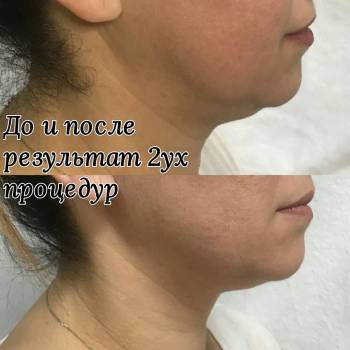 Елена Викторовна Безверхая , Кривой Рог Фото - 17