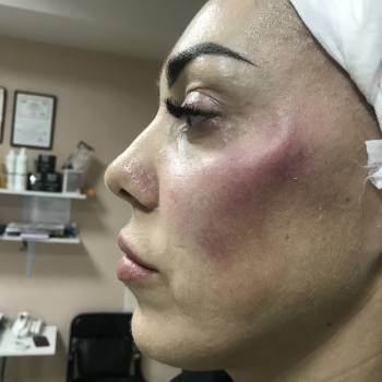 Елена Викторовна Безверхая , Кривой Рог Фото - 27