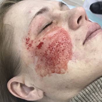 Елена Викторовна Безверхая , Кривой Рог Фото - 29