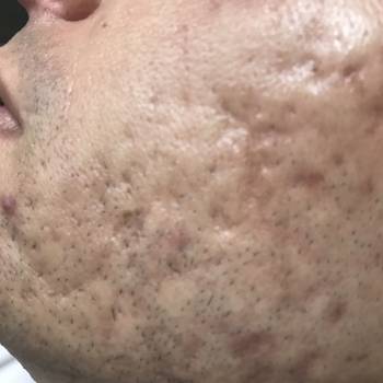 Елена Викторовна Безверхая , Кривой Рог Фото - 31