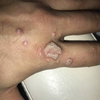 Елена Викторовна Безверхая , Кривой Рог Фото - 40