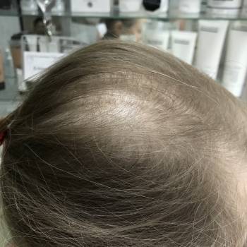 Елена Викторовна Безверхая , Кривой Рог Фото - 42