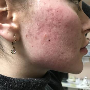 Елена Викторовна Безверхая , Кривой Рог Фото - 45