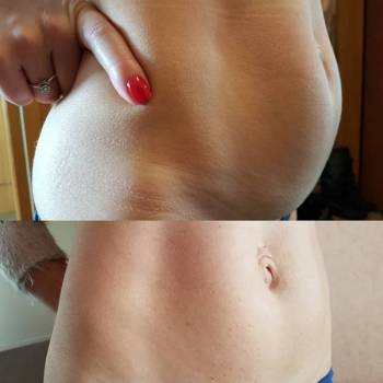 Липолитики