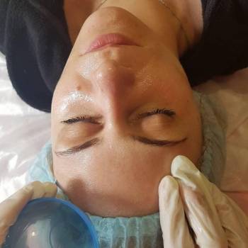 Пилинг феруловый