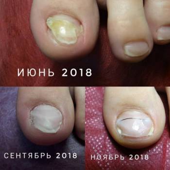 Елена Олеговна Хавер, Черкассы Фото - 49