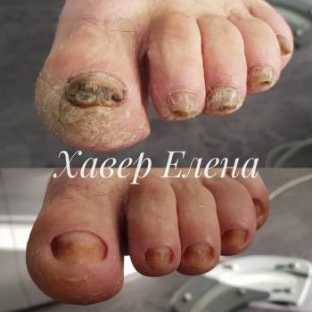 Елена Олеговна Хавер, Черкассы Фото - 50