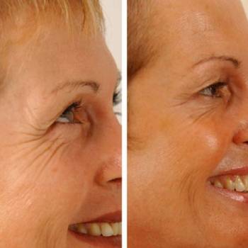 Фото с портфолио Беркутова Ольга 