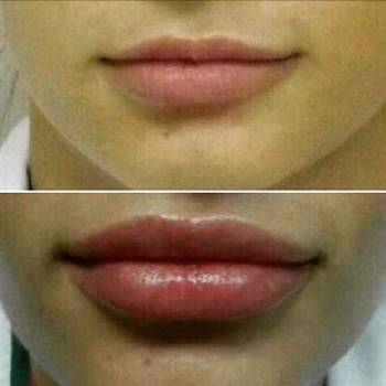 Фото с портфолио Беркутова Ольга 