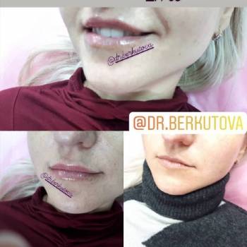 Фото с портфолио Беркутова Ольга 