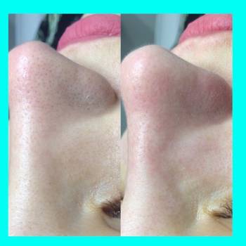 Ганна Іванюк, Черновцы Фото - 12