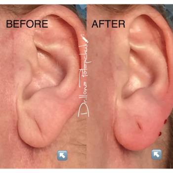 Илона Потапчук Потапчук, Львів Фото - 6