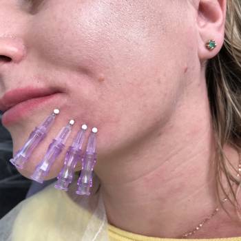 Илона Потапчук Потапчук, Львів Фото - 7