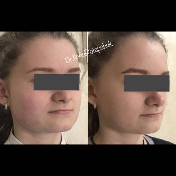 Илона Потапчук Потапчук, Львів Фото - 8