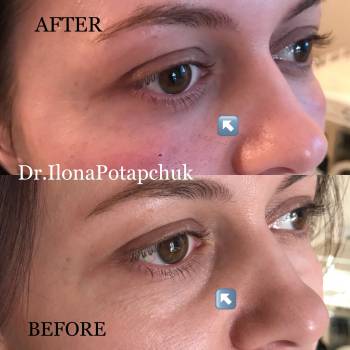 Илона Потапчук Потапчук, Львів Фото - 1