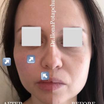 Илона Потапчук Потапчук, Львів Фото - 10