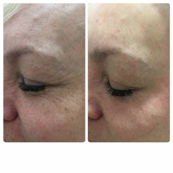 Елена Алова, Херсон Фото - 19