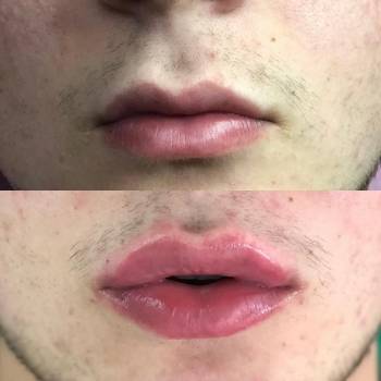 Lazermed, Чернівці Фото - 6