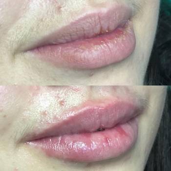 Lazermed, Чернівці Фото - 9