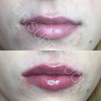 Lazermed, Чернівці Фото - 11