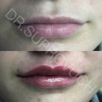 Lazermed, Чернівці Фото - 13