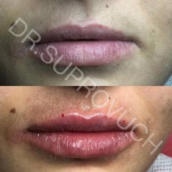 Lazermed, Чернівці Фото - 15