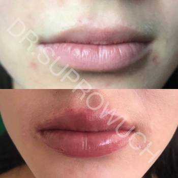 Lazermed, Чернівці Фото - 18